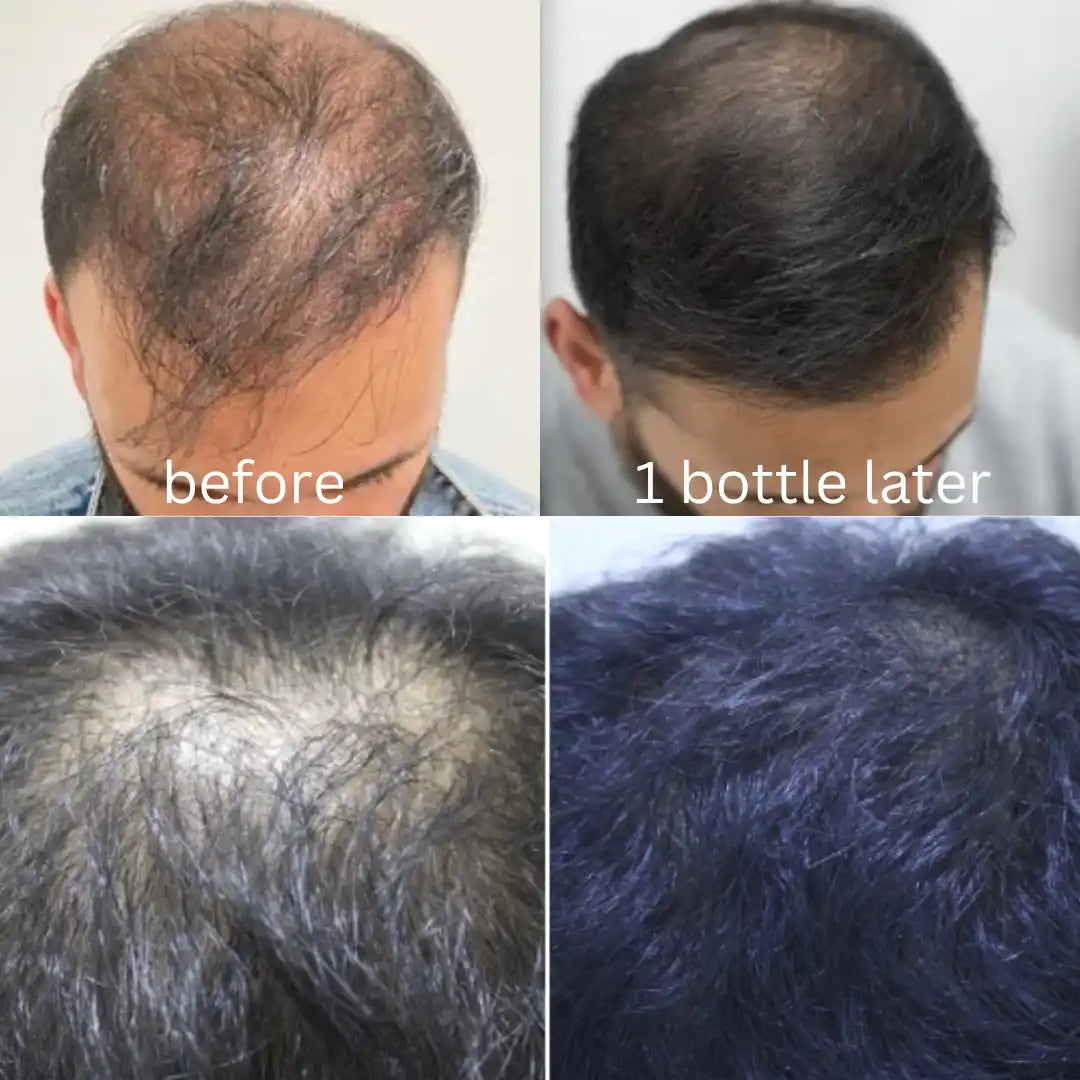 BARKAT.B PREMIUM HERBAL HAIR OIL